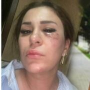 Ülviyyə Rusiyada qəzaya düşdü