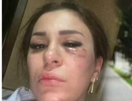 Ülviyyə Rusiyada qəzaya düşdü