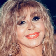 Rühəngiz Allahverdiyeva da plastik əməliyyat etdirir