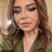 Xalq artisti plastik əməliyyatdan danışmaq istəmədi