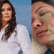 Türkiyəli müğənniyə it hücum etdi — Foto