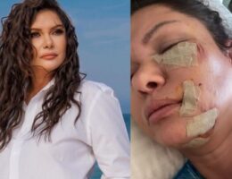 Türkiyəli müğənniyə it hücum etdi — Foto