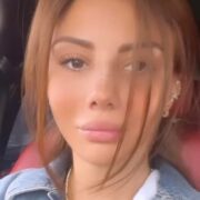 Ayselin plastik əməliyyatdan sonrakı halı — Foto