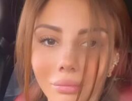 Ayselin plastik əməliyyatdan sonrakı halı — Foto