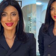 Müğənni imicini dəyişdi — Dodaqları ona yaraşdırılmadı — Foto