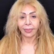 Əməkdar artist estetik əməliyyatın qurbanı oldu: «Çox peşmanam…»