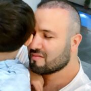 Elnur plastik əməliyyat etdirdi — Foto